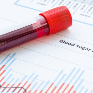 kadar gula darah normal wanita usia 40 tahun