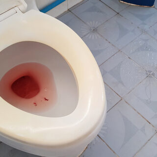Kenapa BAB Keluar Darah
