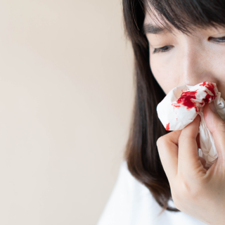 apa penyebab mimisan