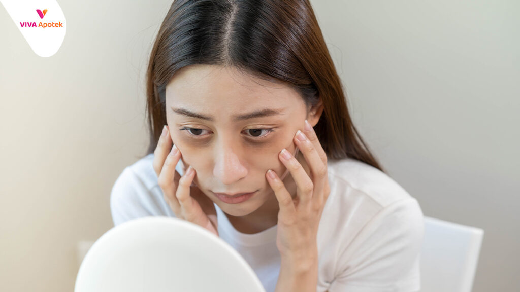 6 Cara Menghilangkan Mata Sembab VIVA Apotek