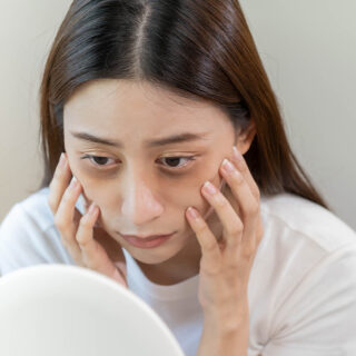 cara menghilangkan mata sembab