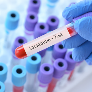 cara menurunkan kreatinin