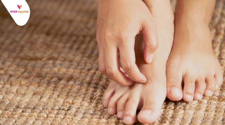 cara menyembuhkan kutu air di kaki