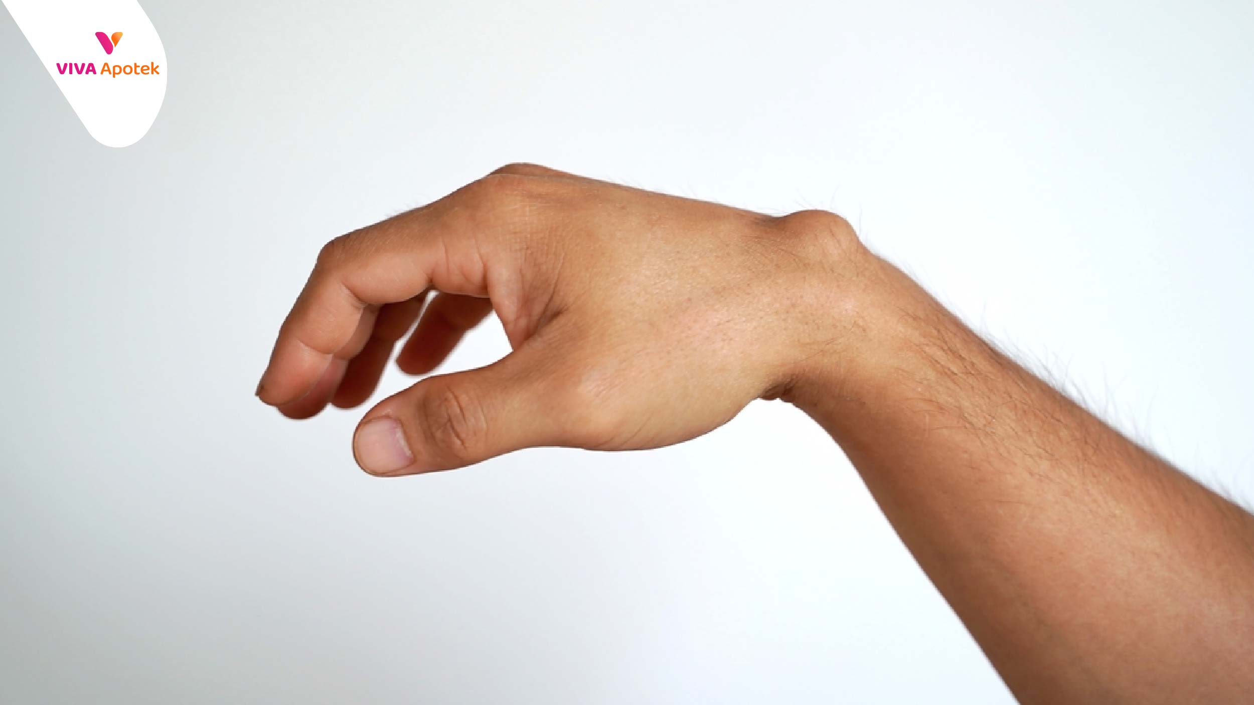 lipoma adalah