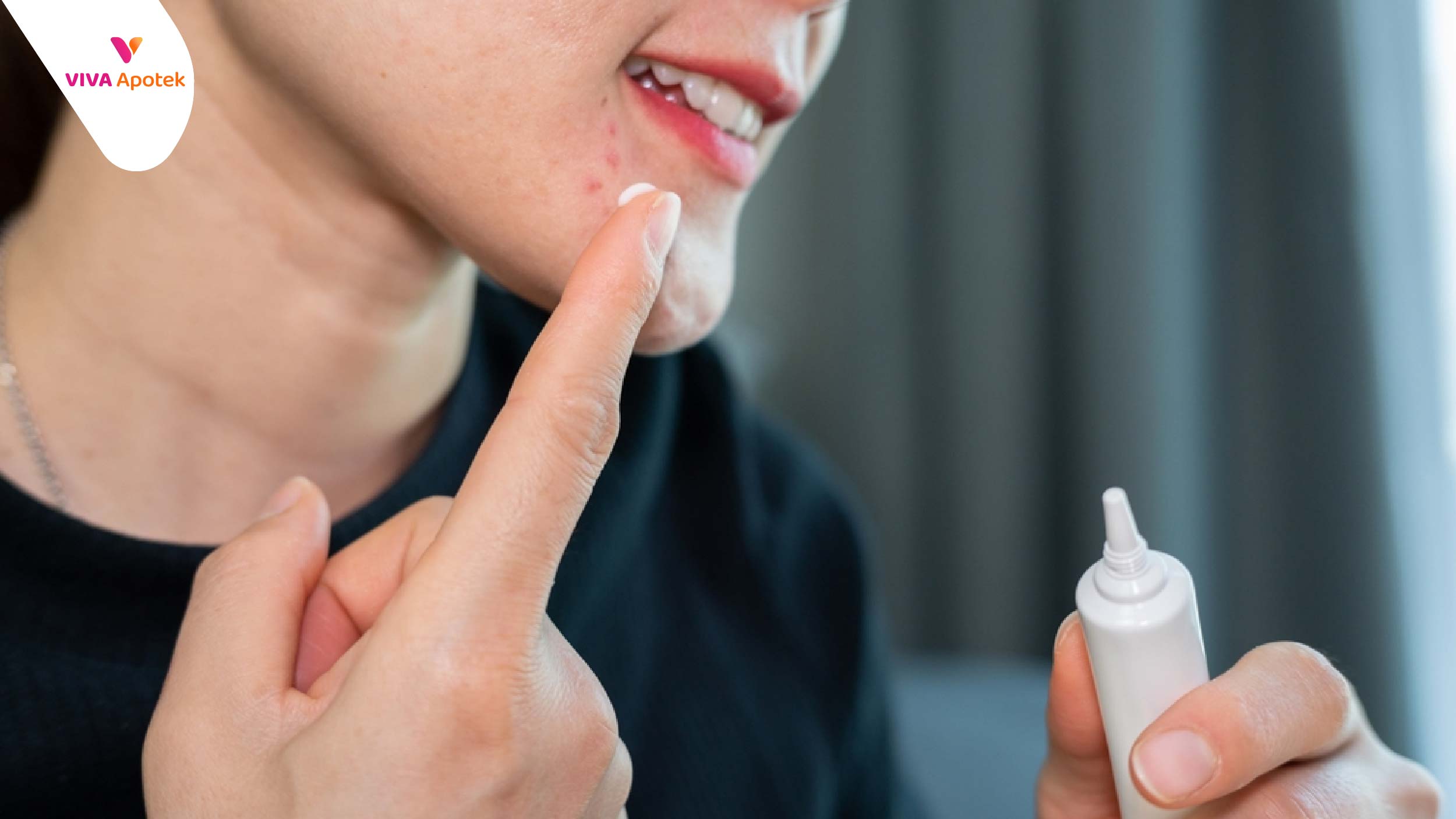 obat jerawat di apotek