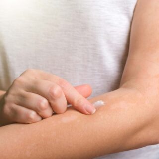 Obat Anti Jamur di Apotek