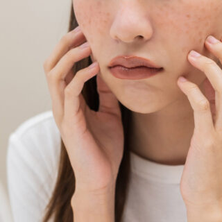 cara alami mengurangi flek hitam di wajah