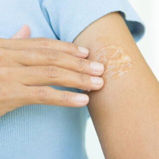 cara efektif memudarkan bekas luka