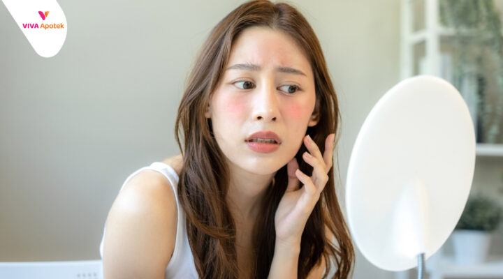 cara mengatasi bekas luka di wajah