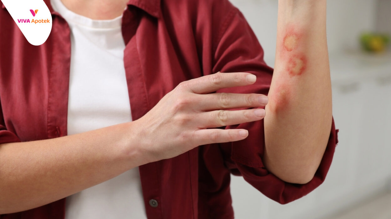 kandungan untuk memudarkan bekas luka