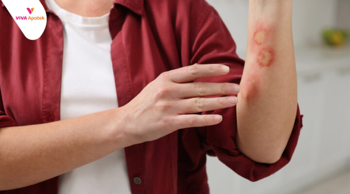 kandungan untuk memudarkan bekas luka