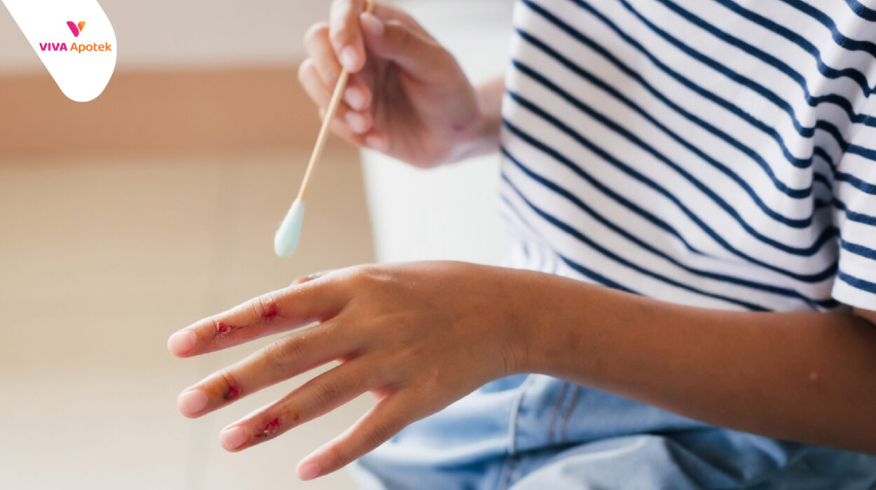 panduan penanganan luka ringan