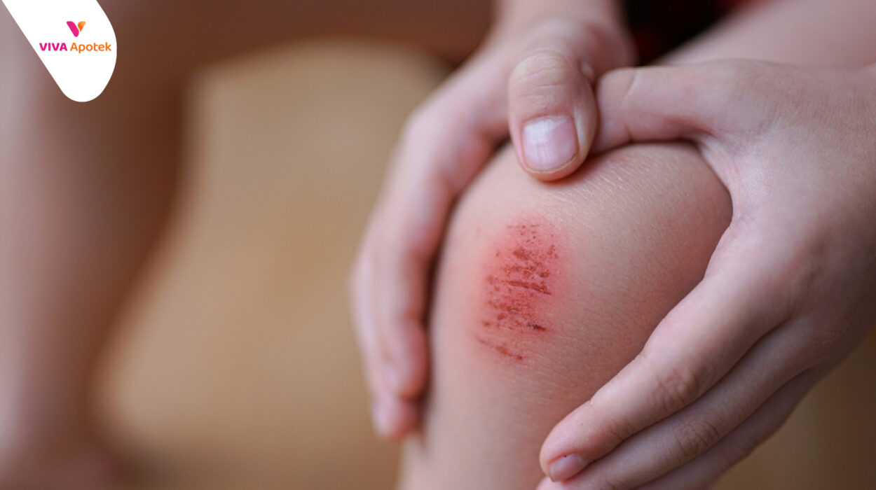 panduan perlindungan untuk luka kecil