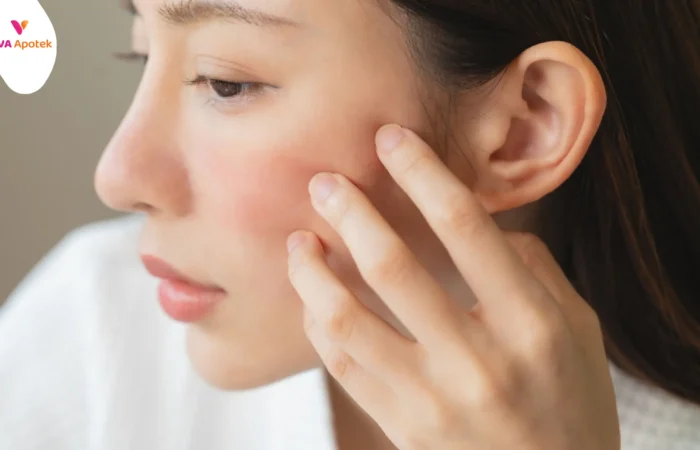 cara menghilangkan bekas jerawat merah