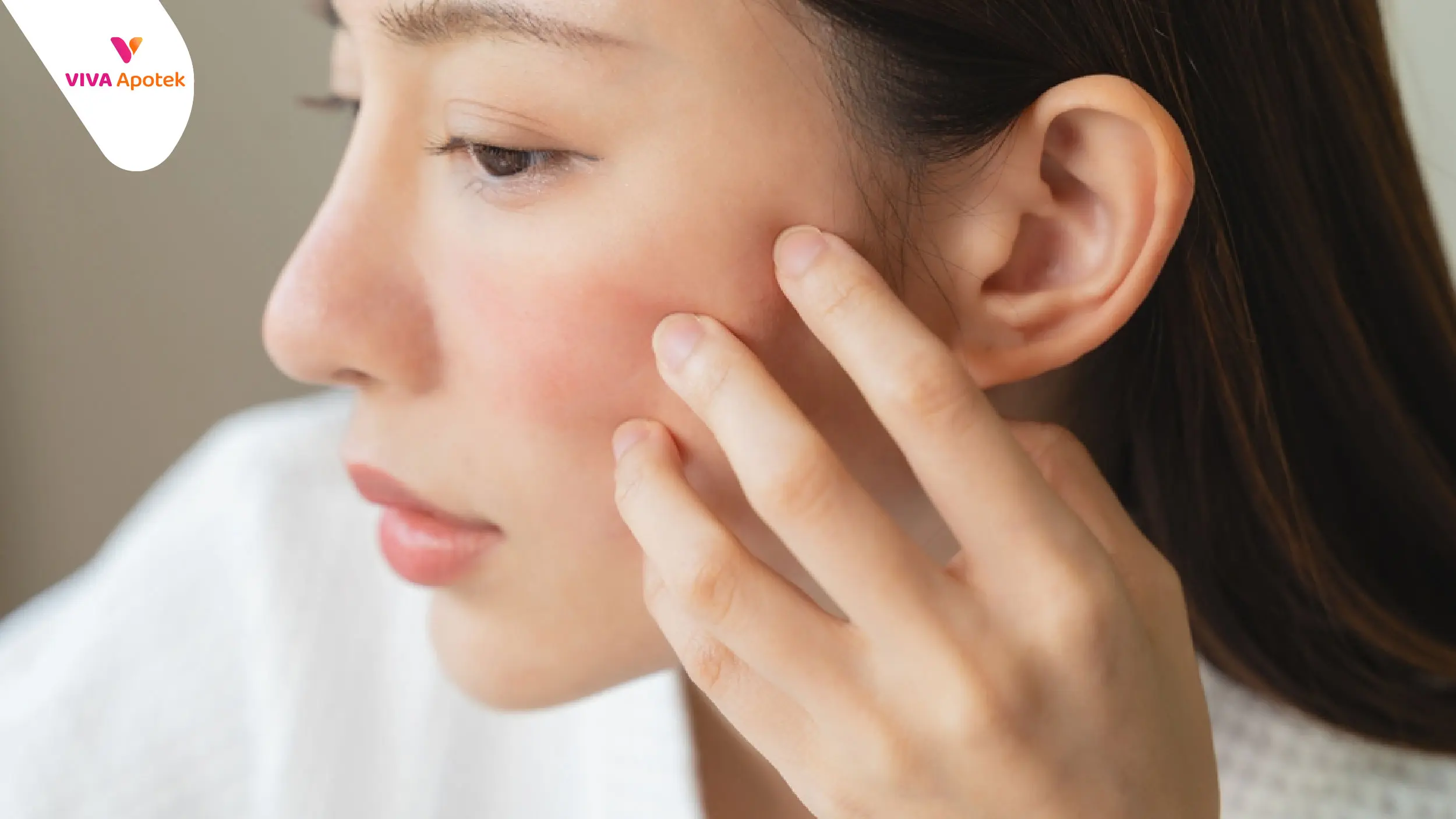 cara menghilangkan bekas jerawat merah