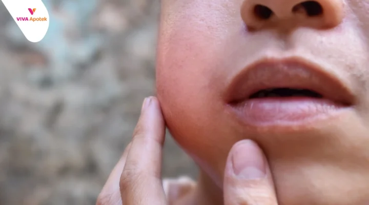 kenapa gondongan tak kunjung kempes