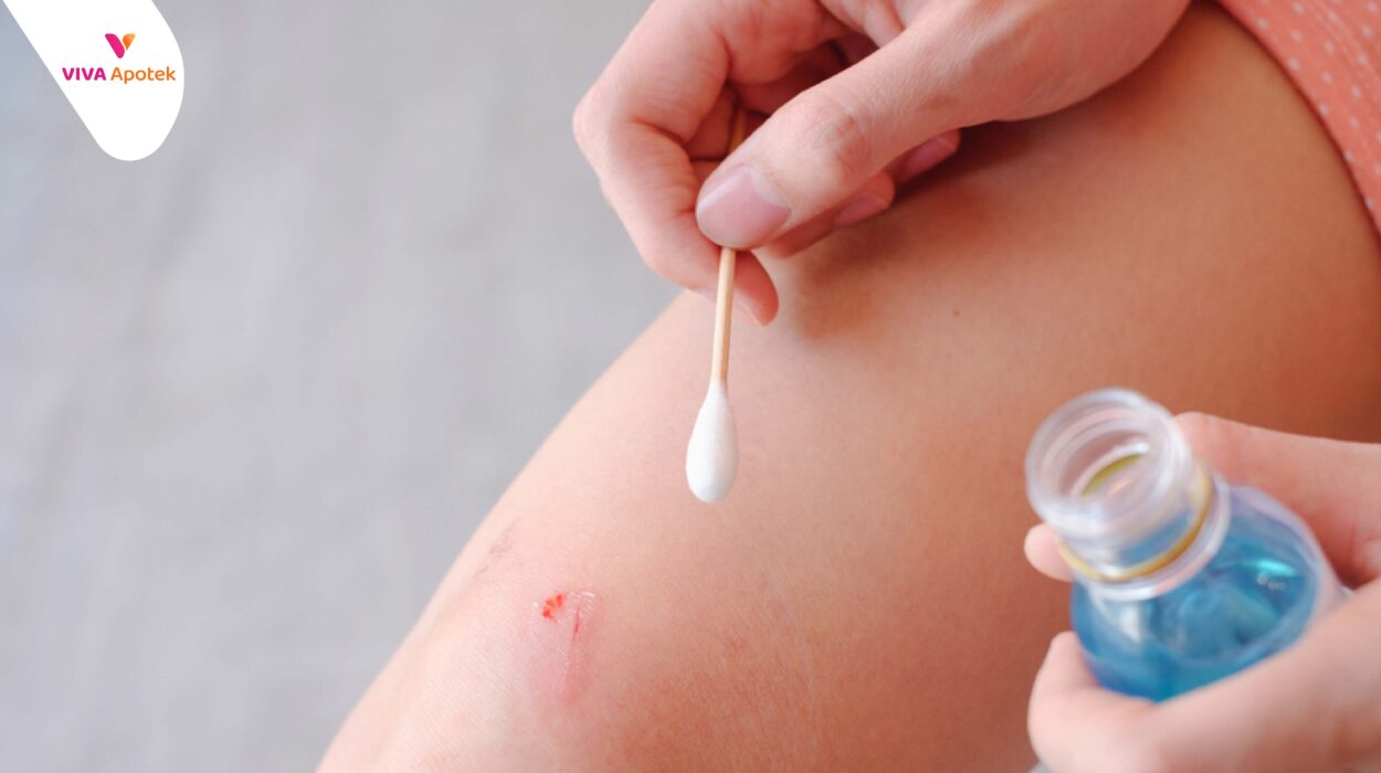 apakah alkohol aman untuk membersihkan luka