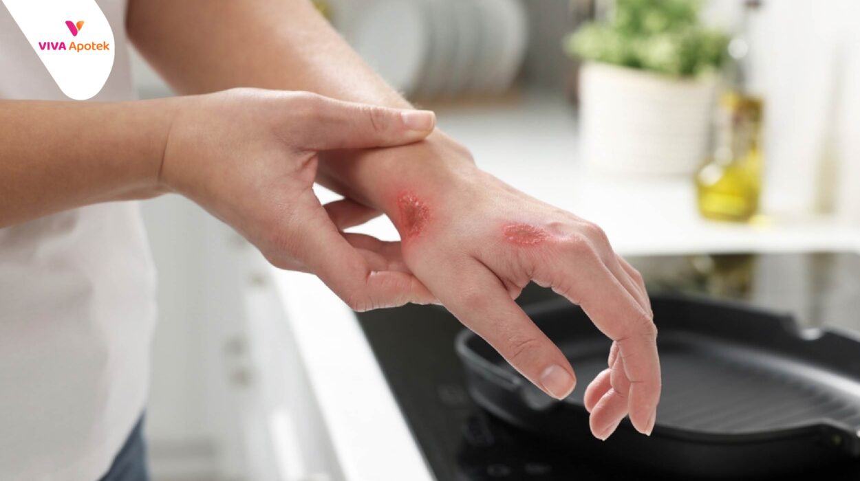 cara agar luka cepat kering