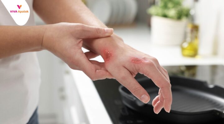 cara agar luka cepat kering