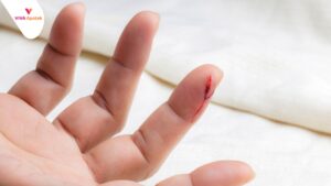 cara mengobati tangan luka kena pisau silet