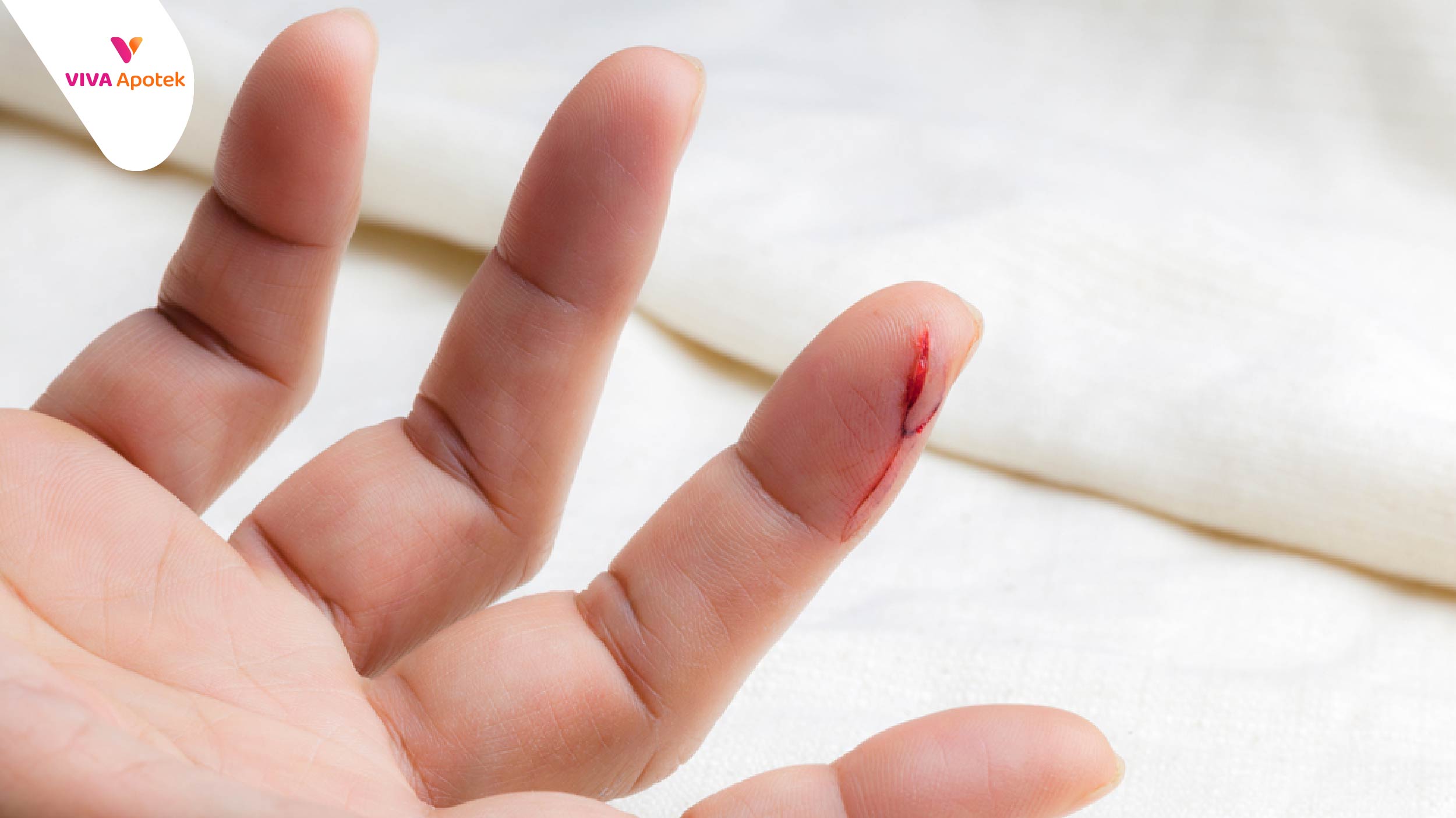 cara mengobati tangan luka kena pisau silet