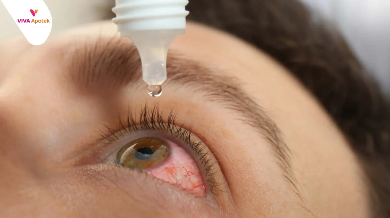 daftar dan harga obat mata merah di apotek