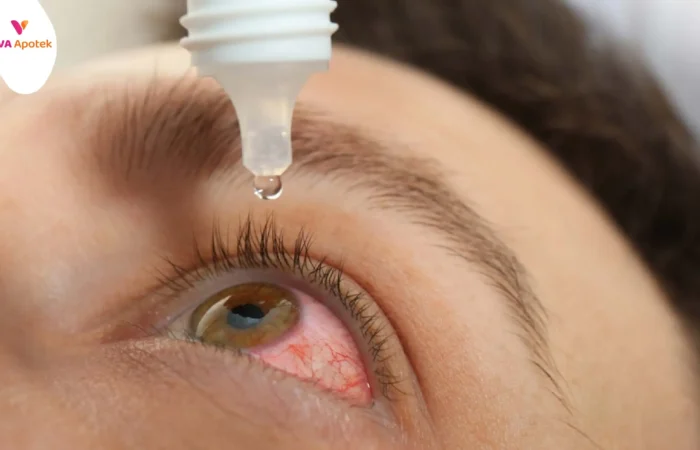 daftar dan harga obat mata merah di apotek