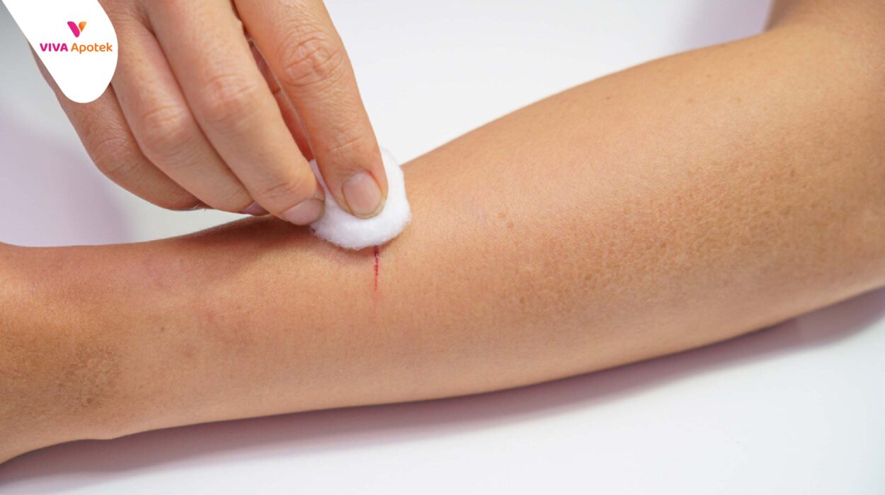 langkah membersihkan luka agar tidak perih