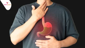 Daftar dan Harga Obat Lambung di Apotek