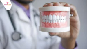 Frenulum Adalah
