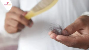 Penyebab Rambut Rontok Parah
